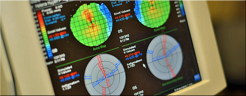 A macro shot of a corneal topography map screen displaying detailed axial color-coded data and simulated K-values, used for diagnosing astigmatism and corneal conditions at Optima Optometry.